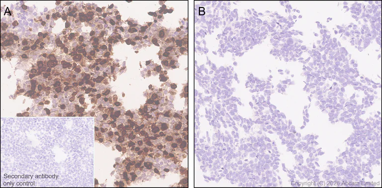 Immunohistochemistry (Formalin/PFA-fixed paraffin-embedded sections) - Anti-SHOX2 antibody [EPR30169-39] (AB326071)