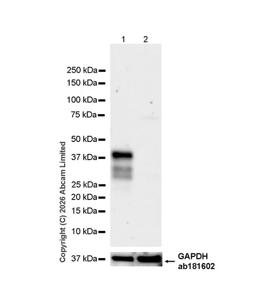 Western blot - Anti-SHOX2 antibody [EPR30169-39] (AB326071)