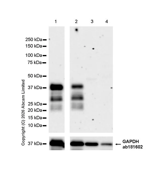 Western blot - Anti-SHOX2 antibody [EPR30169-39] (AB326071)