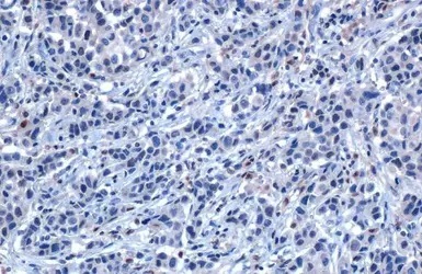 Immunohistochemistry (Formalin/PFA-fixed paraffin-embedded sections) - Anti-SHP1 antibody (AB227503)