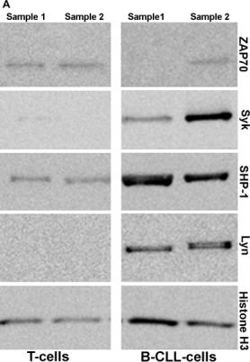 Western blot - Anti-SHP1 antibody [EPR5519] (ab124942), expandable thumbnail