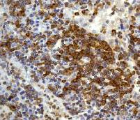 Immunohistochemistry (Formalin/PFA-fixed paraffin-embedded sections) - Anti-SHP1 antibody [Y476] (ab32559), expandable thumbnail