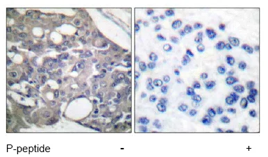 Immunohistochemistry (Formalin/PFA-fixed paraffin-embedded sections) - Anti-SHP1 (phospho Y536) antibody (AB51171)