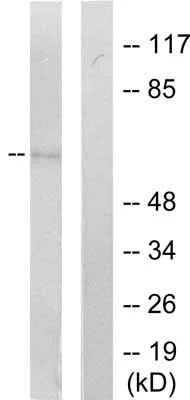Western blot - Anti-SHP1 (phospho Y536) antibody (AB51171)