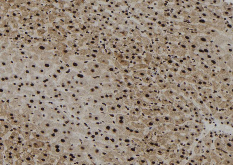 Immunohistochemistry (Formalin/PFA-fixed paraffin-embedded sections) - Anti-SHP1 (phospho Y564) antibody (AB192669)