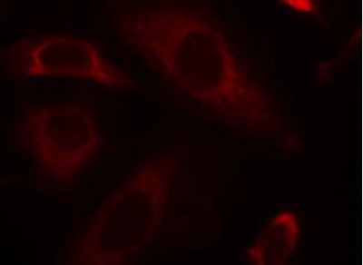 Immunocytochemistry/ Immunofluorescence - Anti-SHP2 antibody (AB131541), expandable thumbnail