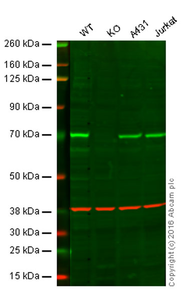 Western blot - Anti-SHP2 antibody [Y477] (AB32159), expandable thumbnail