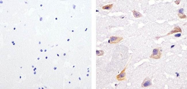 Immunohistochemistry (Formalin/PFA-fixed paraffin-embedded sections) - Anti-SHP2 (phospho Y542) antibody (AB17939)