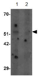 Western blot - Anti-SHQ1 antibody (AB139806), expandable thumbnail
