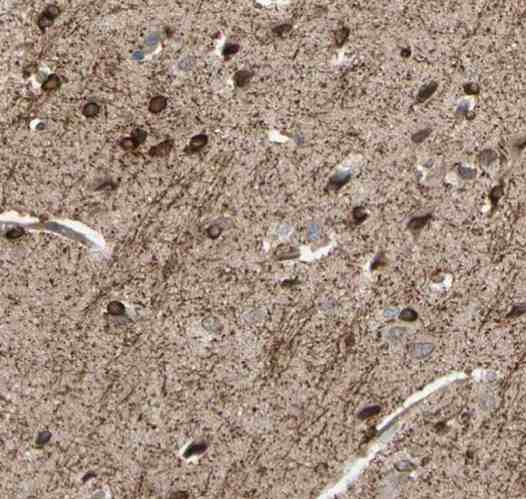 Immunohistochemistry (Formalin/PFA-fixed paraffin-embedded sections) - Anti-SHROOM4 antibody (AB121316), expandable thumbnail