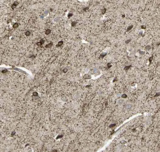 Immunohistochemistry (Formalin/PFA-fixed paraffin-embedded sections) - Anti-SHROOM4 antibody (AB121316)