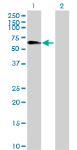 Western blot - Anti-SIAE antibody (AB69300), expandable thumbnail