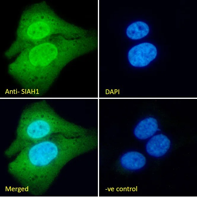 Immunocytochemistry/ Immunofluorescence - Anti-SIAH1 antibody (AB2237)