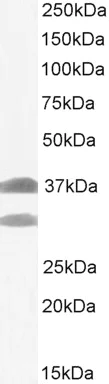 Western blot - Anti-SIAH1 antibody (AB2237)