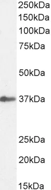 Western blot - Anti-SIAH1 antibody (AB2237)