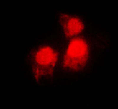 Immunocytochemistry/ Immunofluorescence - Anti-Siah2 antibody - C-terminal (AB230523)