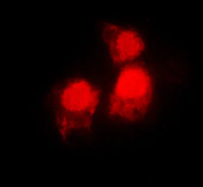 Immunocytochemistry/ Immunofluorescence - Anti-Siah2 antibody - C-terminal (AB230523)
