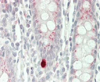 Immunohistochemistry (Formalin/PFA-fixed paraffin-embedded sections) - Anti-Siah2 antibody - C-terminal (AB230523)