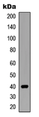 Western blot - Anti-Siah2 antibody - C-terminal (AB230523)