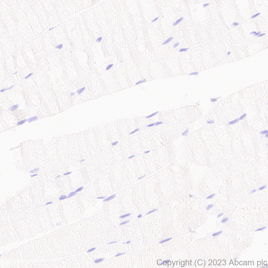 Immunohistochemistry (Formalin/PFA-fixed paraffin-embedded sections) - Anti-Sialoadhesin/CD169 antibody [EPR27102-11] (ab312840), expandable thumbnail