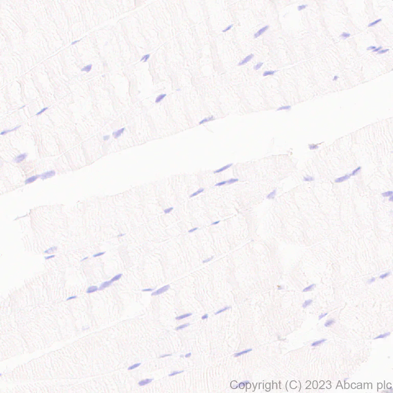 Immunohistochemistry (Formalin/PFA-fixed paraffin-embedded sections) - Anti-Sialoadhesin/CD169 antibody [EPR27102-11] (AB312840)