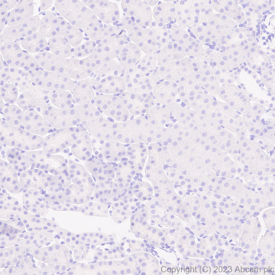 Immunohistochemistry (Formalin/PFA-fixed paraffin-embedded sections) - Anti-Sialoadhesin/CD169 antibody [EPR27102-11] (ab312840), expandable thumbnail