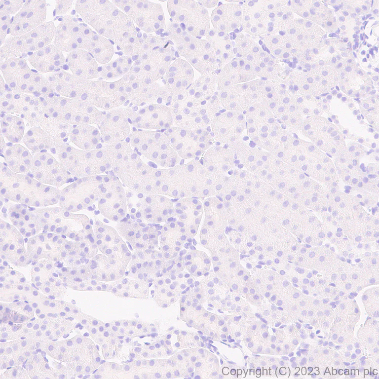 Immunohistochemistry (Formalin/PFA-fixed paraffin-embedded sections) - Anti-Sialoadhesin/CD169 antibody [EPR27102-11] (AB312840)