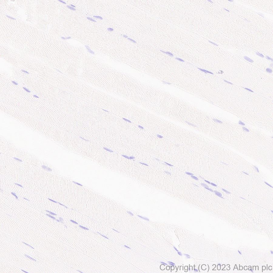 Immunohistochemistry (Formalin/PFA-fixed paraffin-embedded sections) - Anti-Sialoadhesin/CD169 antibody [EPR27102-11] (ab312840), expandable thumbnail