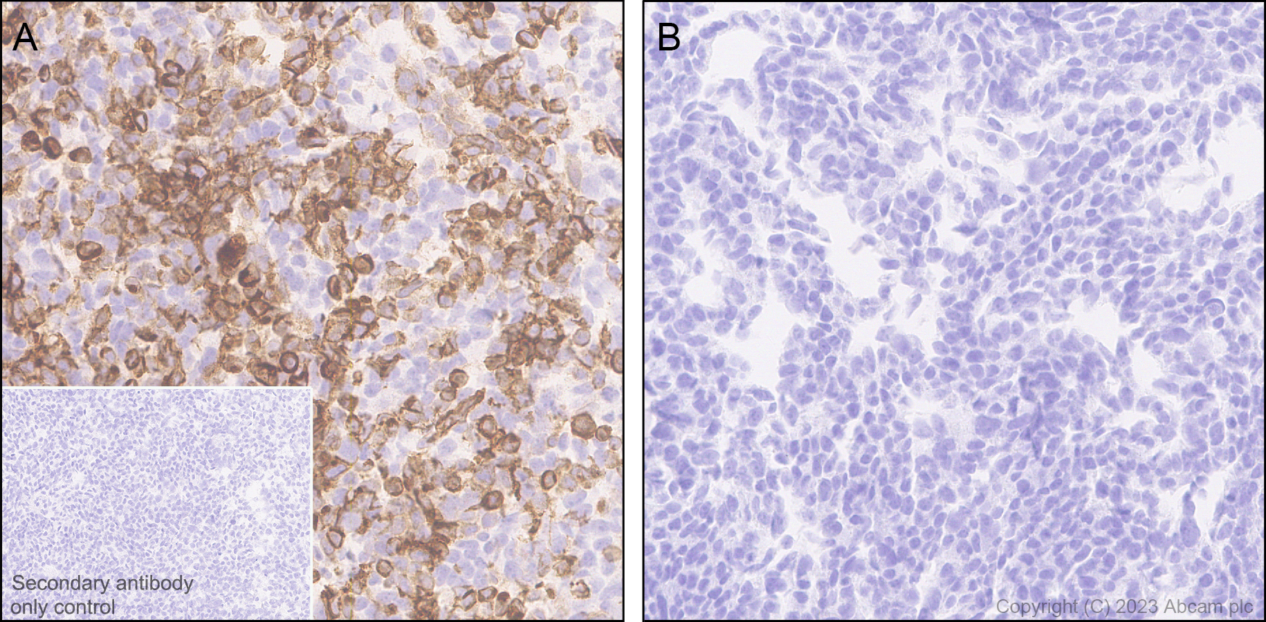 Immunohistochemistry (Formalin/PFA-fixed paraffin-embedded sections) - Anti-Sialoadhesin/CD169 antibody [EPR27102-11] (ab312840), expandable thumbnail