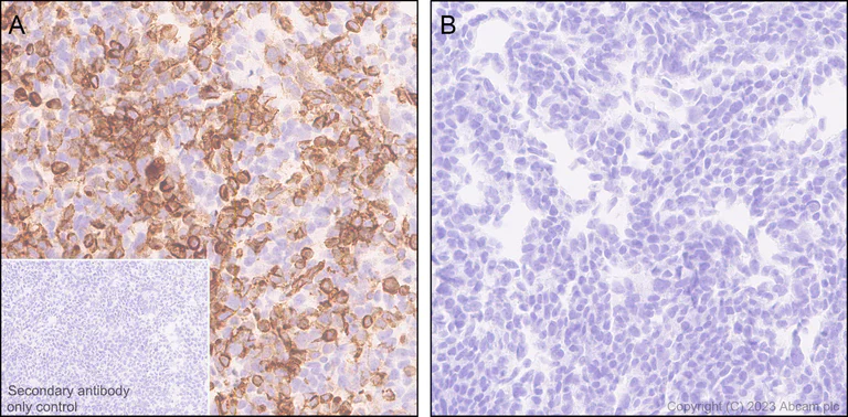 Immunohistochemistry (Formalin/PFA-fixed paraffin-embedded sections) - Anti-Sialoadhesin/CD169 antibody [EPR27102-11] (AB312840)