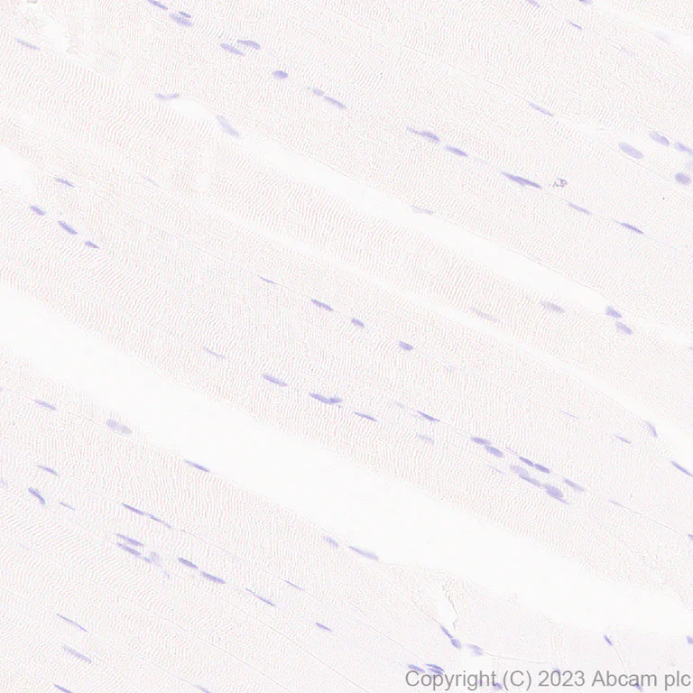 Immunohistochemistry (Formalin/PFA-fixed paraffin-embedded sections) - Anti-Sialoadhesin/CD169 antibody [EPR27102-11] - BSA and Azide free (AB312841)