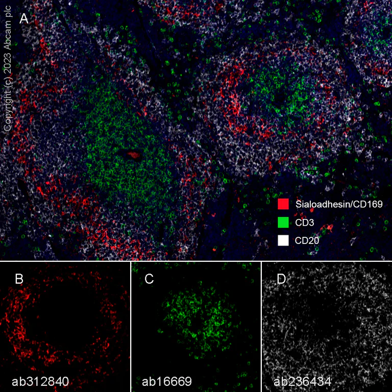 Multiplex immunohistochemistry - Anti-Sialoadhesin/CD169 antibody [EPR27102-11] - BSA and Azide free (AB312841)
