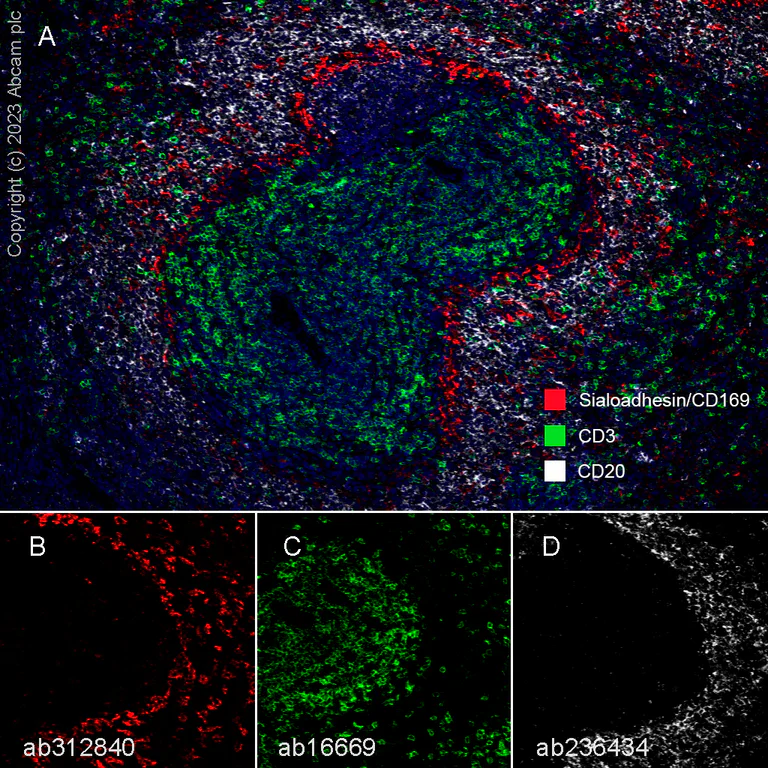 Multiplex immunohistochemistry - Anti-Sialoadhesin/CD169 antibody [EPR27102-11] - BSA and Azide free (AB312841)
