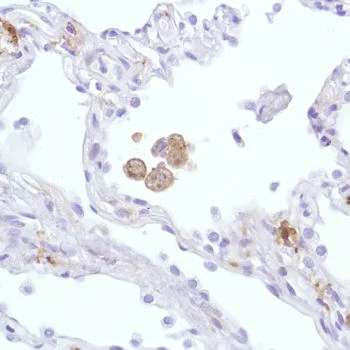 Immunohistochemistry (Formalin/PFA-fixed paraffin-embedded sections) - Anti-Sialoadhesin/CD169 antibody [SP213] - BSA and Azide free (AB245735)