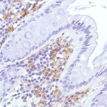 Immunohistochemistry (Formalin/PFA-fixed paraffin-embedded sections) - Anti-Sialoadhesin/CD169 antibody [SP213] - BSA and Azide free (AB245735)