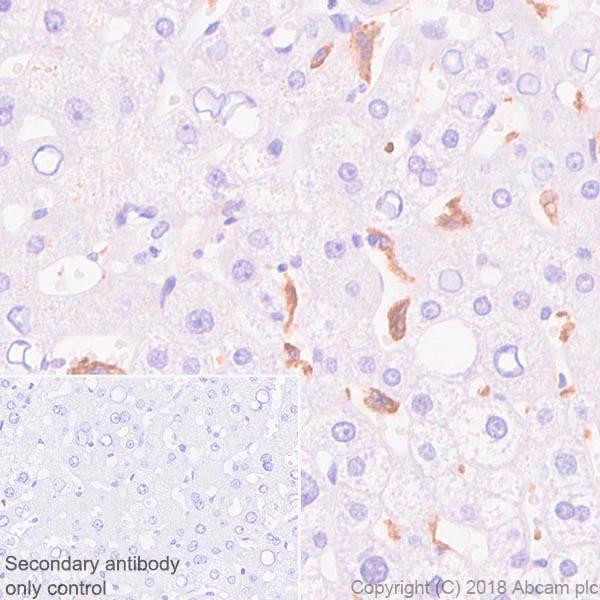 Immunohistochemistry (Formalin/PFA-fixed paraffin-embedded sections) - Anti-Sialoadhesin/CD169 antibody [SP213] - C-terminal (AB227672)