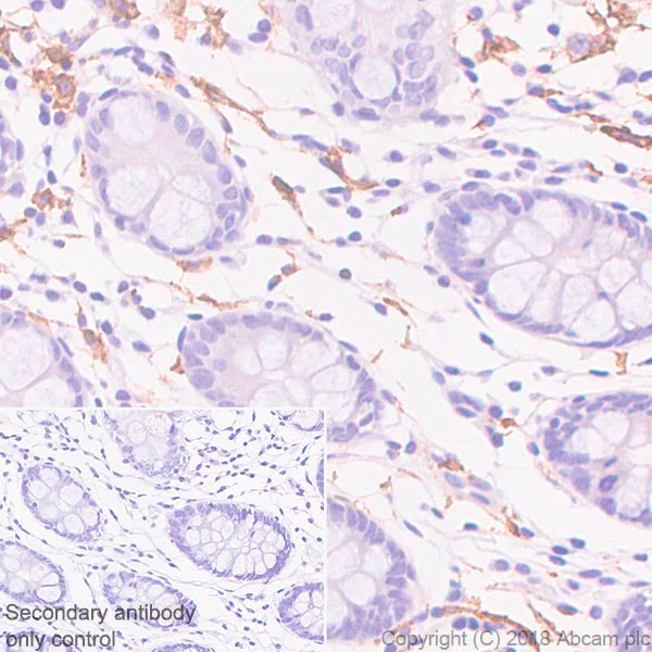 Immunohistochemistry (Formalin/PFA-fixed paraffin-embedded sections) - Anti-Sialoadhesin/CD169 antibody [SP213] - C-terminal (AB227672)