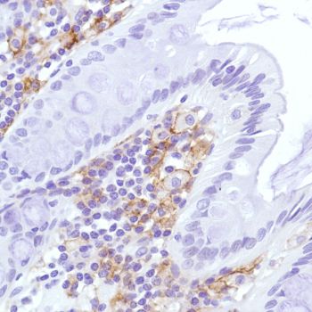 Immunohistochemistry (Formalin/PFA-fixed paraffin-embedded sections) - Anti-Sialoadhesin/CD169 antibody [SP213] - C-terminal (AB227672)