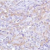 Immunohistochemistry (Formalin/PFA-fixed paraffin-embedded sections) - Anti-Sialoadhesin/CD169 antibody [SP216] (AB183356)