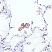 Immunohistochemistry (Formalin/PFA-fixed paraffin-embedded sections) - Anti-Sialoadhesin/CD169 antibody [SP216] - BSA and Azide free (AB245742)