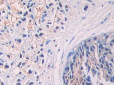 Immunohistochemistry (Formalin/PFA-fixed paraffin-embedded sections) - Anti-SIGIRR antibody (AB233146), expandable thumbnail