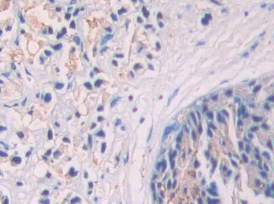 Immunohistochemistry (Formalin/PFA-fixed paraffin-embedded sections) - Anti-SIGIRR antibody (AB233146)