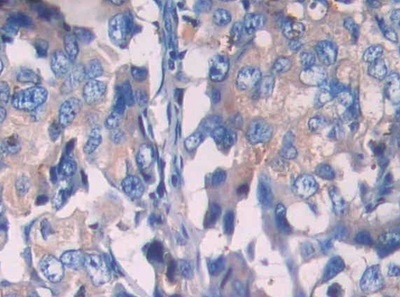 Immunohistochemistry (Formalin/PFA-fixed paraffin-embedded sections) - Anti-SIGIRR antibody (ab233146), expandable thumbnail