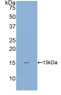 Western blot - Anti-SIGIRR antibody (AB233146), expandable thumbnail