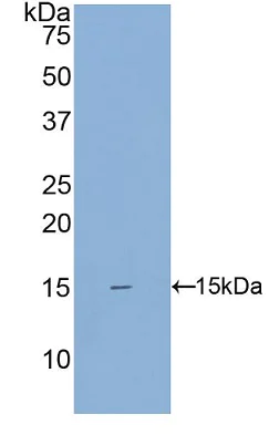 Western blot - Anti-SIGIRR antibody (AB233146)