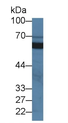 Western blot - Anti-SIGIRR antibody (AB233146)