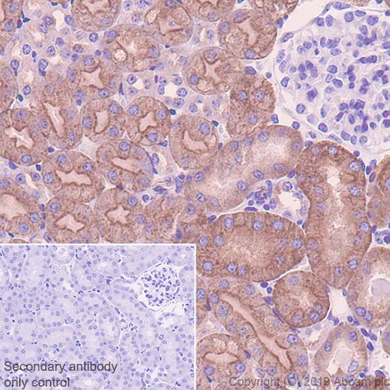 Immunohistochemistry (Formalin/PFA-fixed paraffin-embedded sections) - Anti-SIGIRR antibody [EPR22438-93] - BSA and Azide free (AB256314)