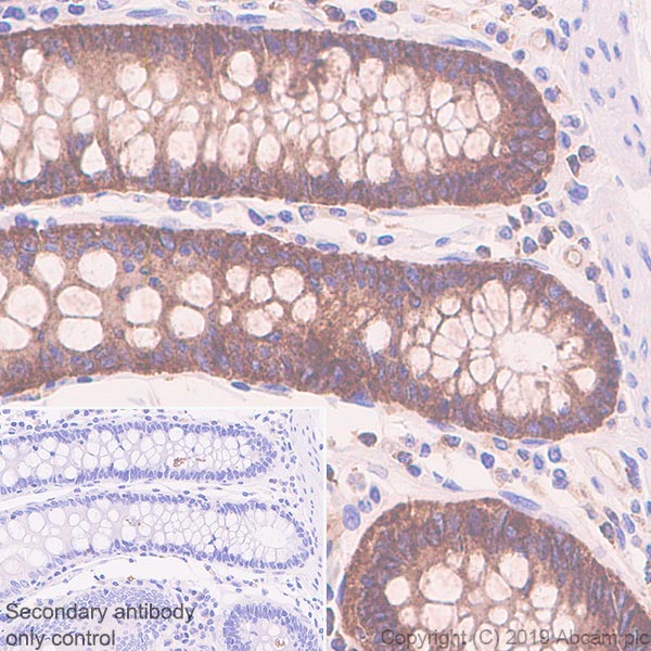 Immunohistochemistry (Formalin/PFA-fixed paraffin-embedded sections) - Anti-SIGIRR antibody [EPR22438-93] - BSA and Azide free (AB256314)