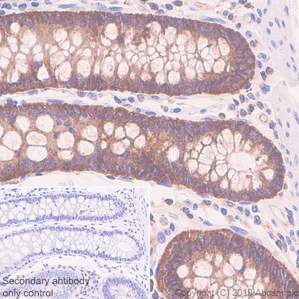 Immunohistochemistry (Formalin/PFA-fixed paraffin-embedded sections) - Anti-SIGIRR antibody [EPR22438-93] - BSA and Azide free (AB256314)