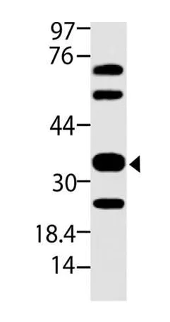 Western blot - Anti-SIGLEC H antibody [ABM2B55] (AB228448)